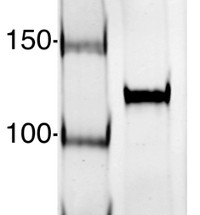 AGO1-PAZ | Argonaute 1 PAZ domain (Chlamydomonas)